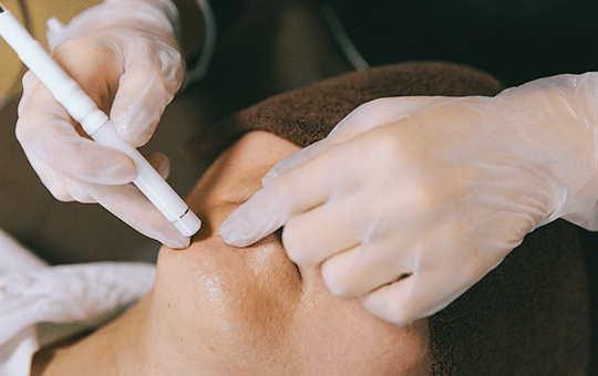 浜松エリアで希少な「美容電気脱毛」を導入